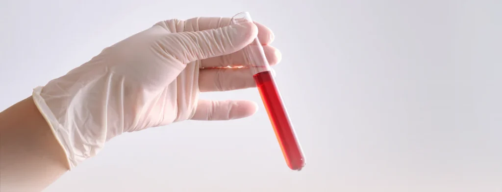 testing tube with blood
